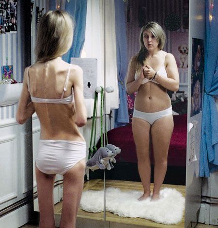 Trastornos Alimentarios. Etiología. Eating Disorders. Etiology.